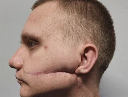 Ukraine_Story_thumb.jpg