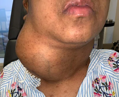preop_11.13.2020.jpg
