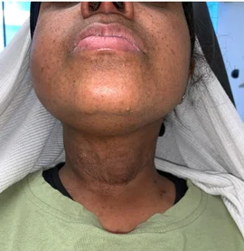 post_op_10.6.2021.jpg